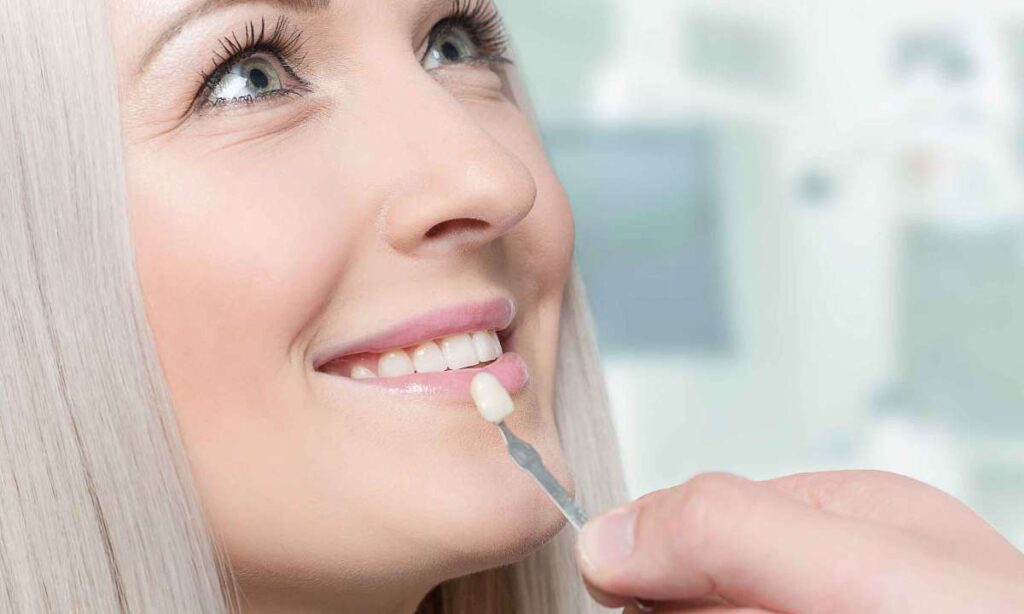 Veneers for Beautiful Teeth: Natural-looking Dental Restoration