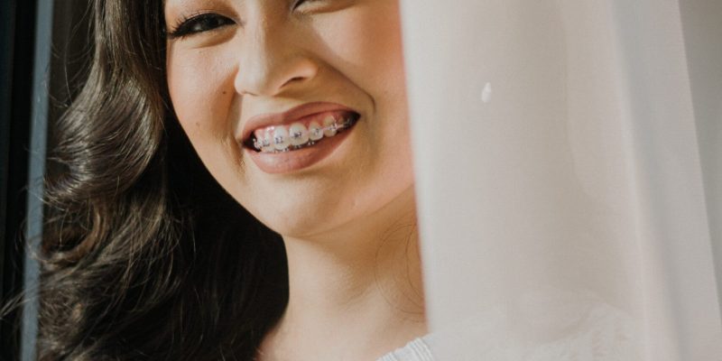 Cost of Traditional Braces - Braces wearing Patient